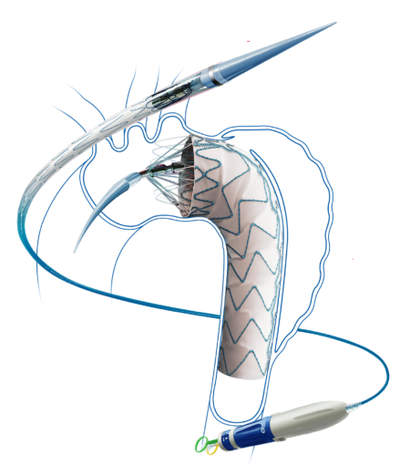 Torasik Aort Hastalıkları Hercules TR 1