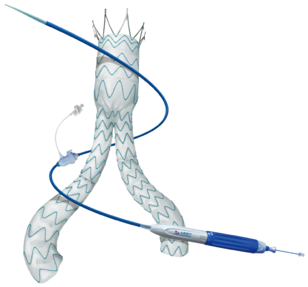 Abdominal Aort Hastalığı Minos TR 1