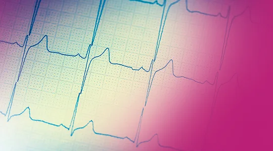 Coronary Artery Disease DIAGNOSIS 1