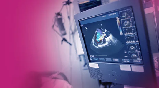 Aortic Aneurism Patients Abnominal aortic Aneurysm2 1