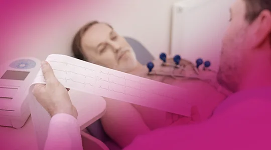 Bradycardia Patients Abnormal Heartbeat bradycardia3 1