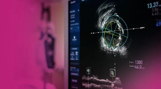 Arteriosclerosis Patients Arteriosclerosis2 1