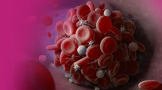 Stroke Patients stroke2 1