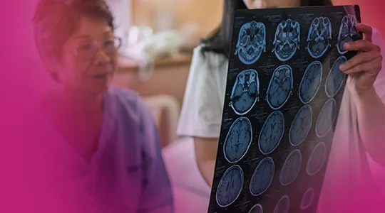 Stroke Patients stroke4 1