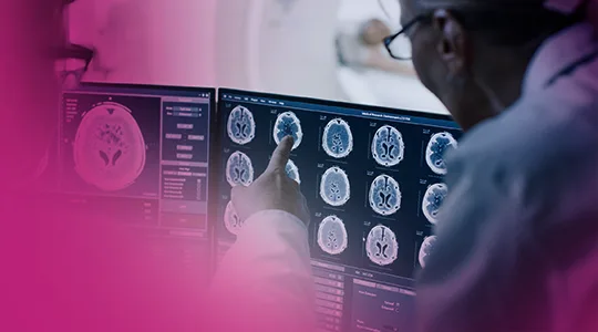 Stroke Patients stroke8 1